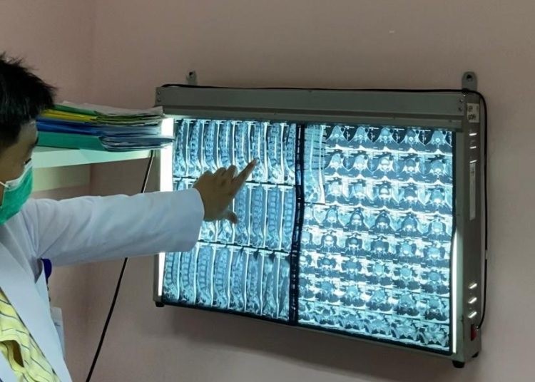 Tak Perlu Berobat Keluar Negeri, RI Kembangkan Layanan Unggulan Orthopedi